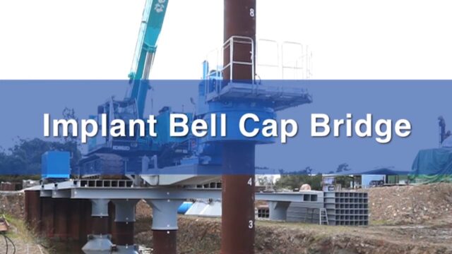 Implant Bell Cap Bridgeの画像