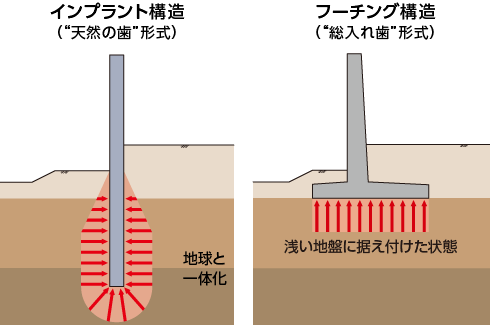 インプラント構造とフーチング構造の構造概念
